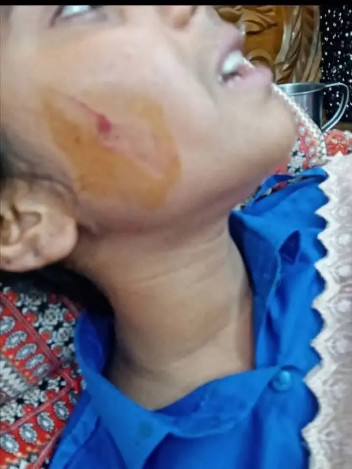 সীতাকুন্ডে সন্ত্রাসীদের ছুরিকাঘাতে স্কুল ছাত্রী আহত ছিনিয়ে নেওয়া হয়েছে গলার চেইন ও কানের দুল